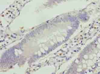VPS25 Antibody