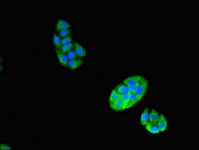 VPS29 Antibody