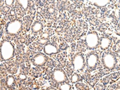 VPS33A Antibody