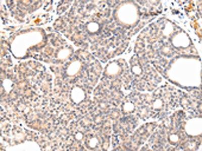 VPS33A Antibody