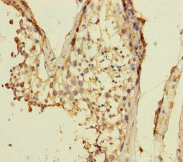 VPS33B Antibody
