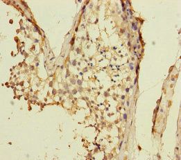 VPS33B antibody