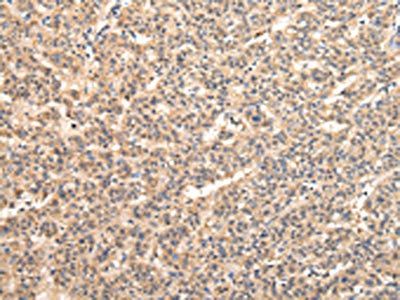 VPS33B antibody