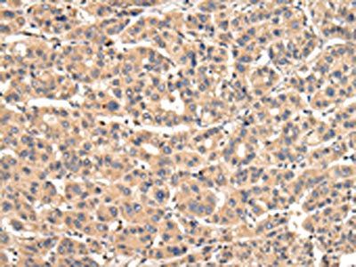 VPS35 Antibody