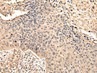 VPS35 Antibody