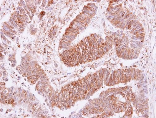 VPS35 antibody [C3], C-term