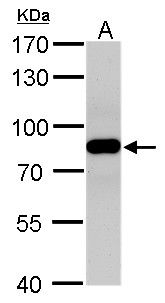 VPS35 antibody [C3], C-term