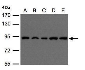 VPS35 antibody [C3], C-term