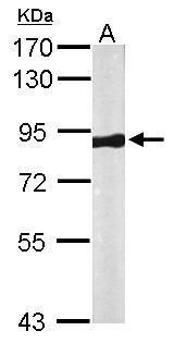 VPS35 antibody [C3], C-term