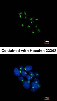 VPS35 antibody