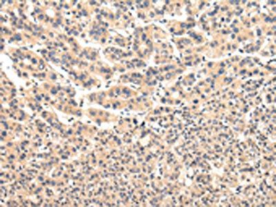 VPS37A Antibody
