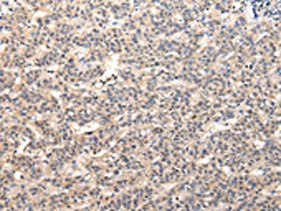 VPS37A Antibody