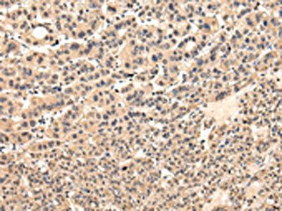 VPS37D antibody