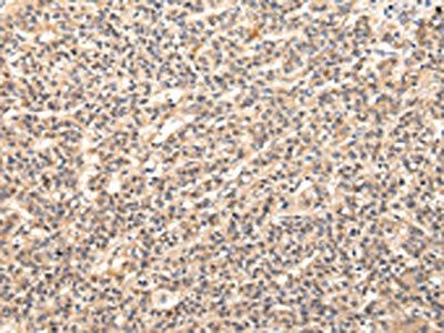 VPS37D Antibody