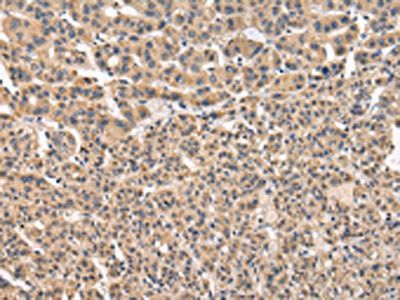VPS41 Antibody