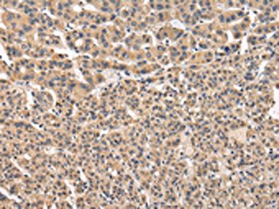 VPS41 antibody