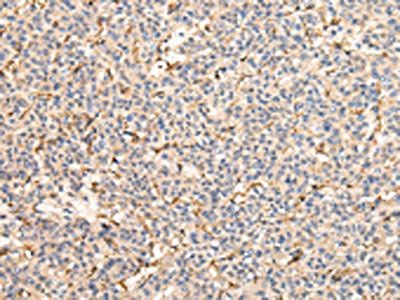 VPS41 Antibody