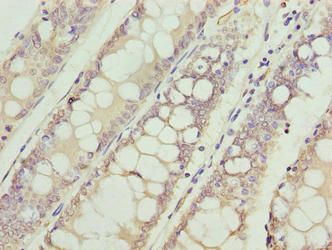 VPS45 Antibody