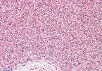 Goat anti-VPS45 (Internal) Antibody
