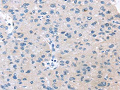 VPS4B Antibody