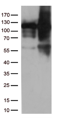 VPS50 Antibody