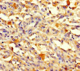 VPS50 Antibody