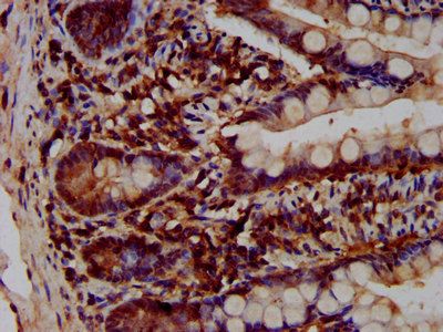 VPS52 Antibody