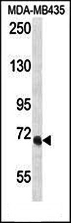 VPS52 antibody