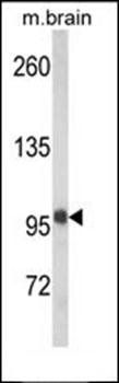 VPS53 antibody