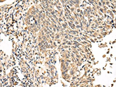 VPS53 Antibody