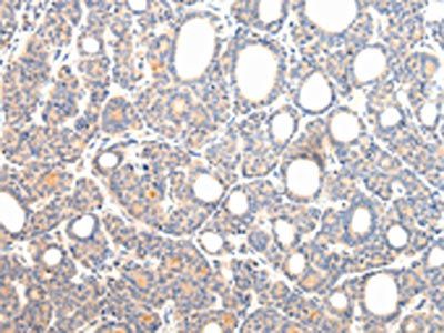 VPS54 Antibody
