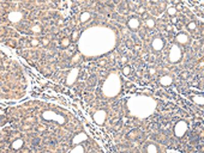 VPS54 Antibody