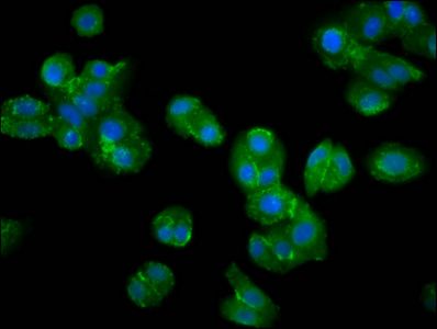 VRK2 antibody