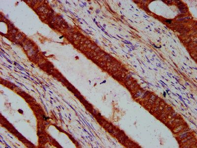 VRK2 Antibody