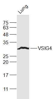 VSIG4 antibody