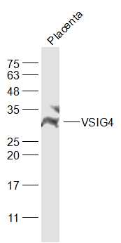 VSIG4 antibody