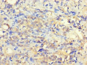 VTA1 antibody