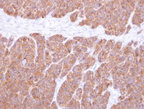 vesicle trafficking 1 Antibody