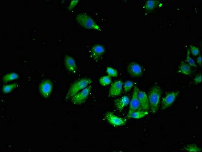 VTI1A antibody