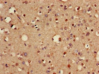 VTI1A Antibody