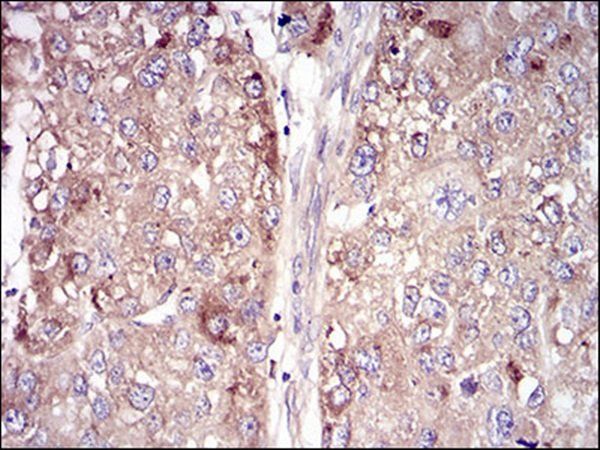 VTN Antibody