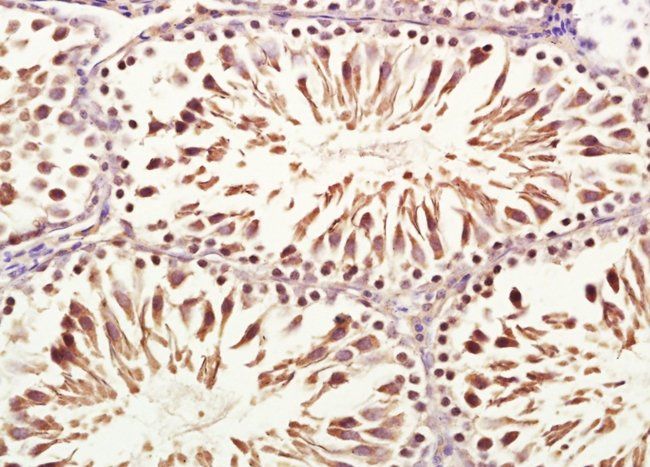 VWCE Rabbit Polyclonal Antibody