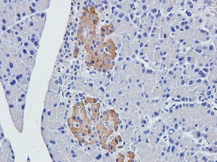 vWF antibody