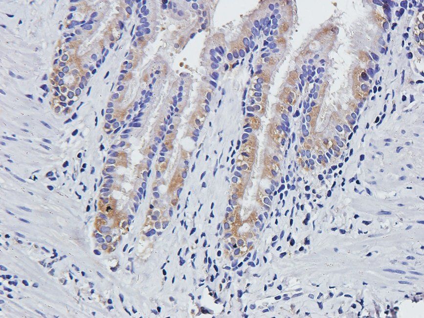 vWF antibody