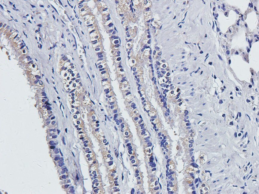 vWF antibody