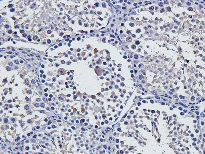 vWF antibody