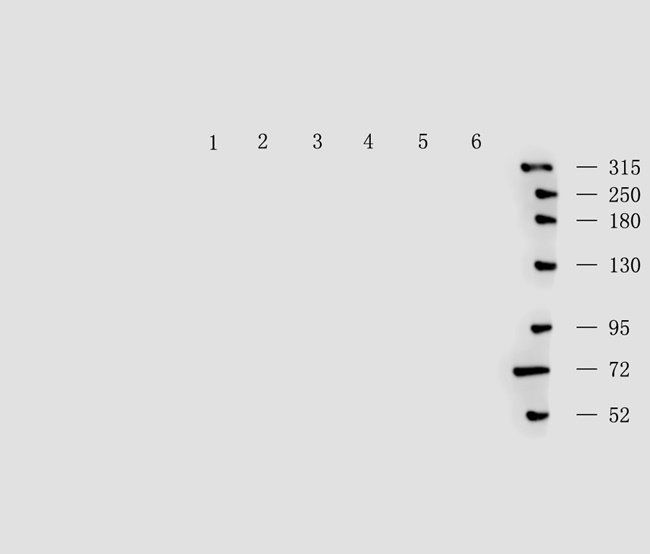 vWF antibody