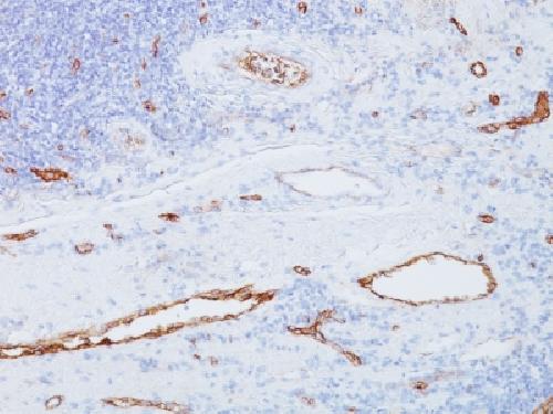von Willebrand Factor / Factor VIII Related-Ag (Endothelial Marker) Antibody
