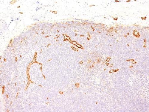 von Willebrand Factor / Factor VIII Related-Ag (Endothelial Marker) Antibody