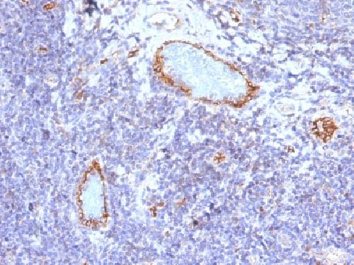 von Willebrand Factor / Factor VIII Related-Ag (Endothelial Marker) Antibody